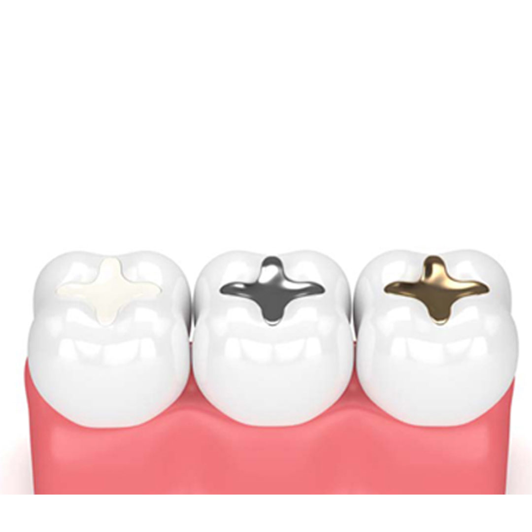 Dental Filling available in online  pharmacy qatar, doha 